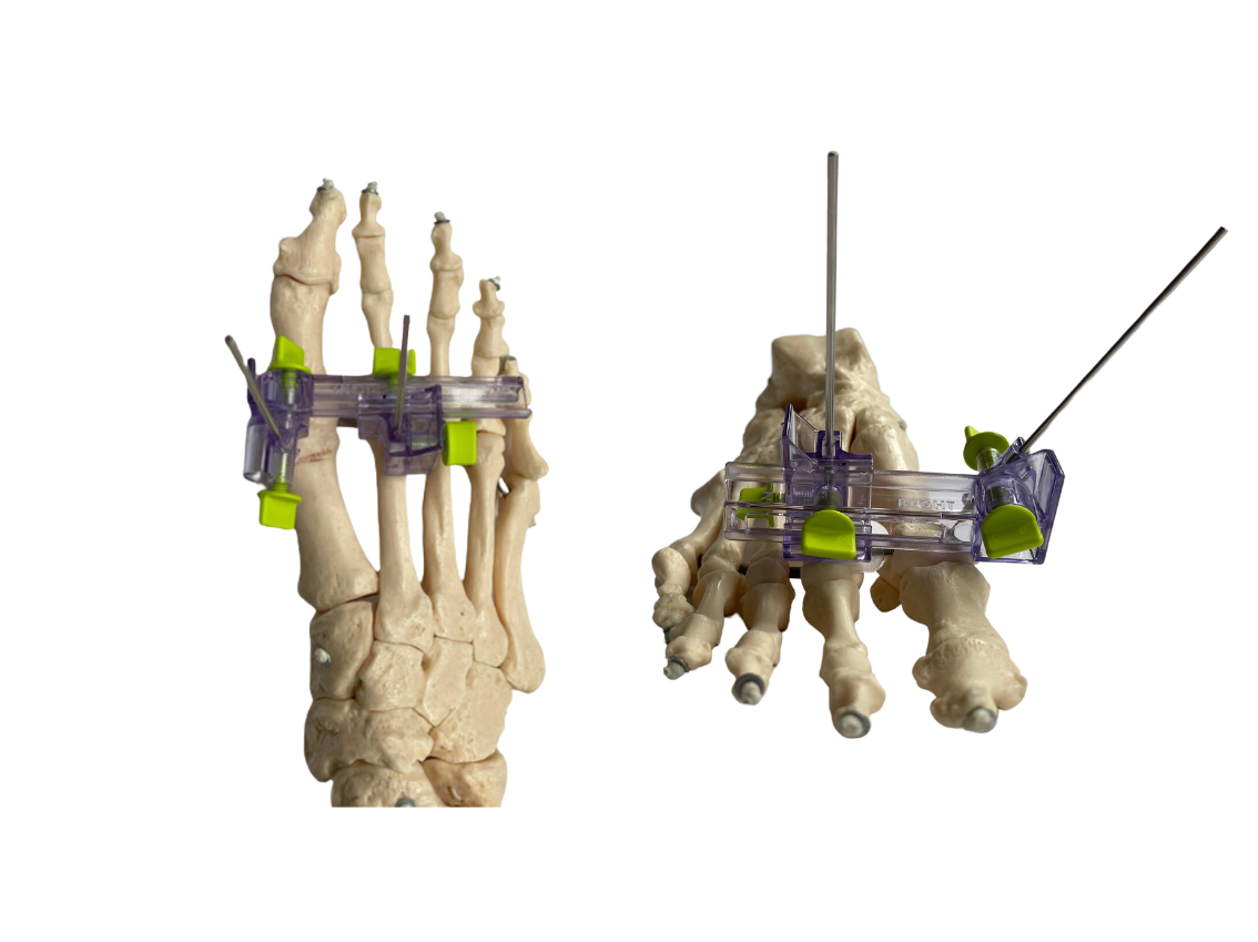 https://www.reljainnovations.com/wp-content/uploads/2023/09/Lapiclamp-on-larger-white-background2.png